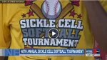 sickle cell anemia