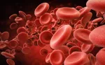 sickle cell anemia