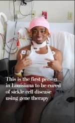 sickle cell anemia