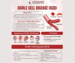sickle cell anemia