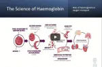 sickle cell anemia