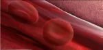 sickle cell anemia