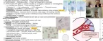 sickle cell anemia