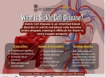 sickle cell anemia