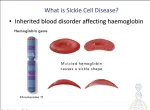 sickle cell