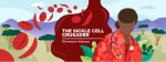 sickle cell anemia