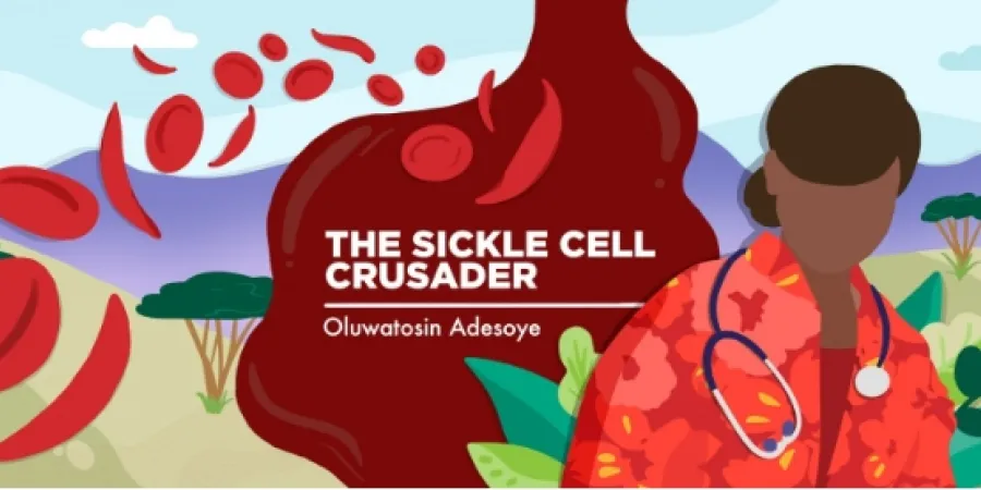 sickle cell anemia