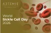 Sickle Cell Anemia