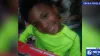 sickle cell anemia