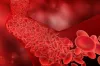 sickle cell anemia